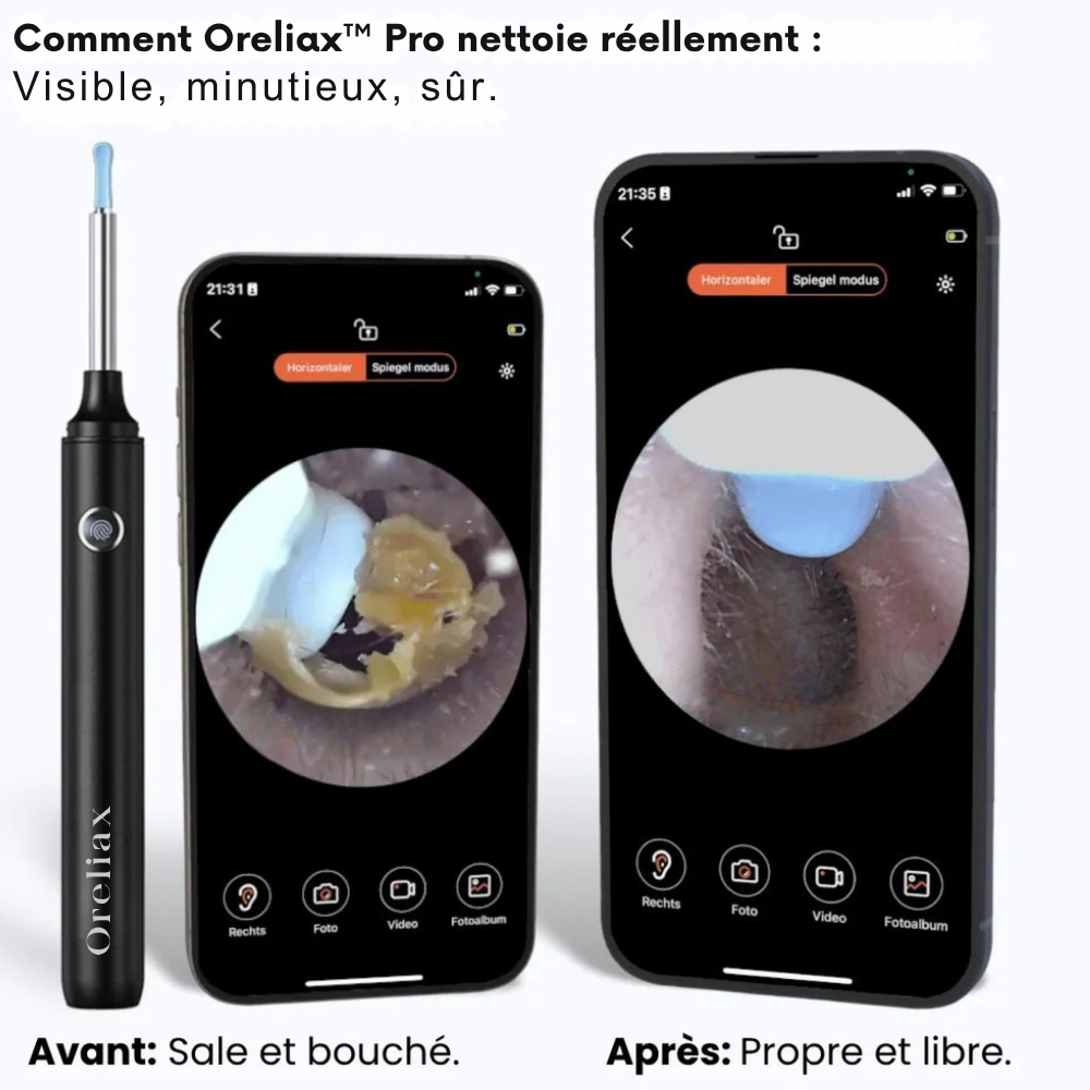 Oreliax™ Pro
